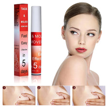 Load image into Gallery viewer, Buy 1 Get 1 FREE šāØTags & Moles Remover,! āØ