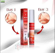 Load image into Gallery viewer, Buy 1 Get 1 FREE šāØTags & Moles Remover,! āØ