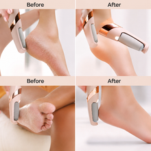 Load image into Gallery viewer, 🔥🛍️ Top-Rated Pedicure Tool  Rechargeable ✨  with a 180-Day Money Back Guarantee! 💖✨
